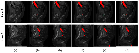 Automatic Segmentation in 3D CT Images: A Comparative Study of Deep ...