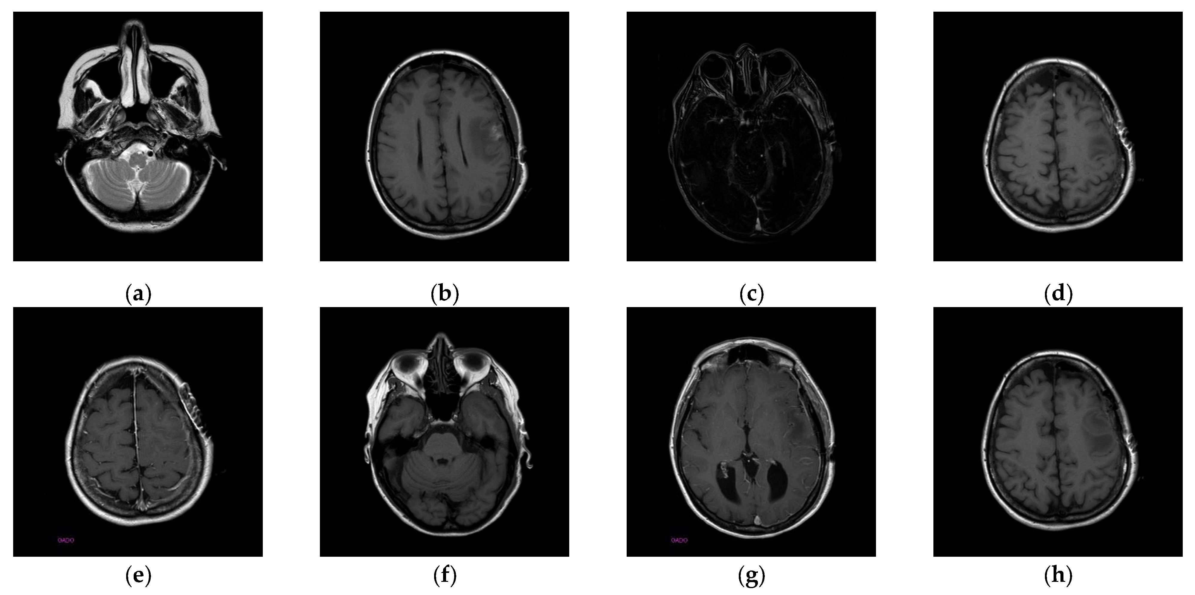 Electronics 14 00122 g010