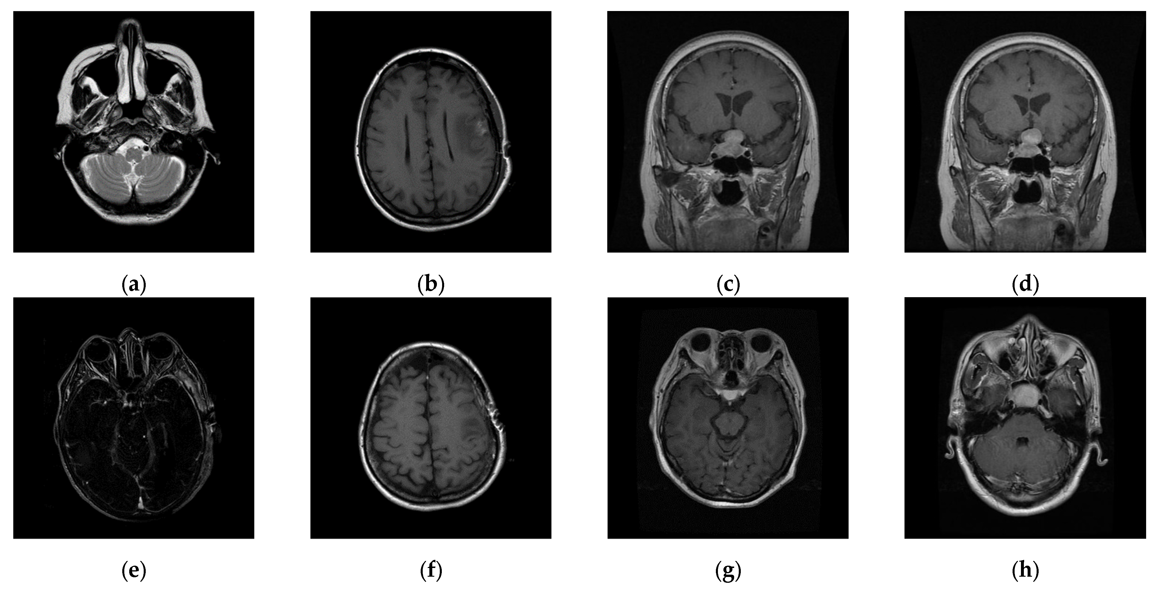 Electronics 14 00122 g011