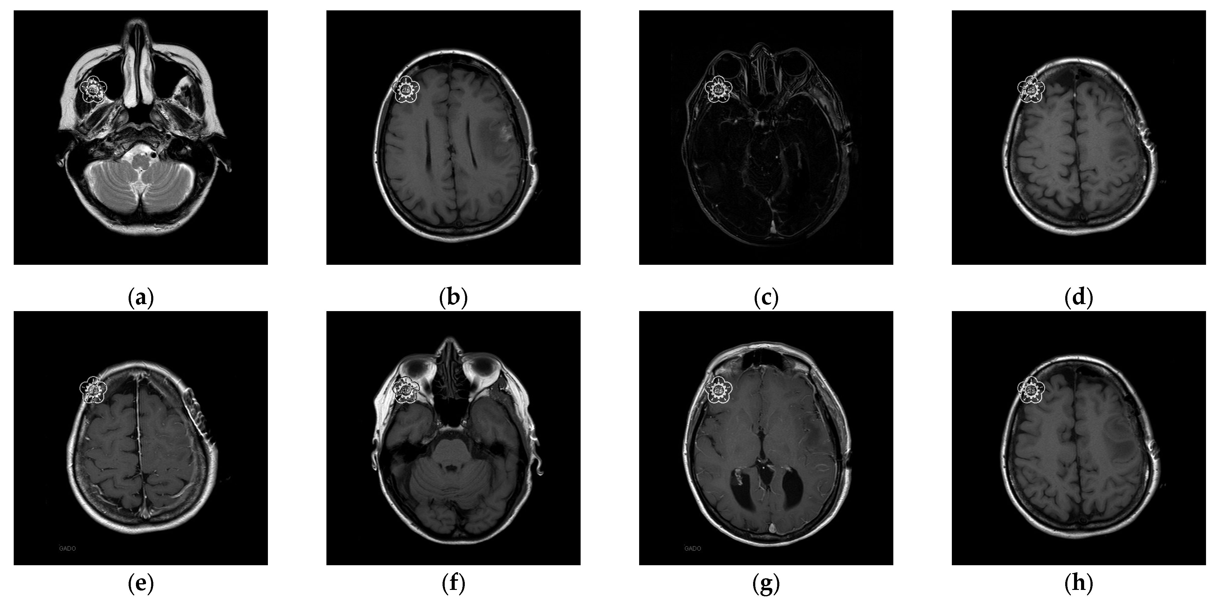 Electronics 14 00122 g015