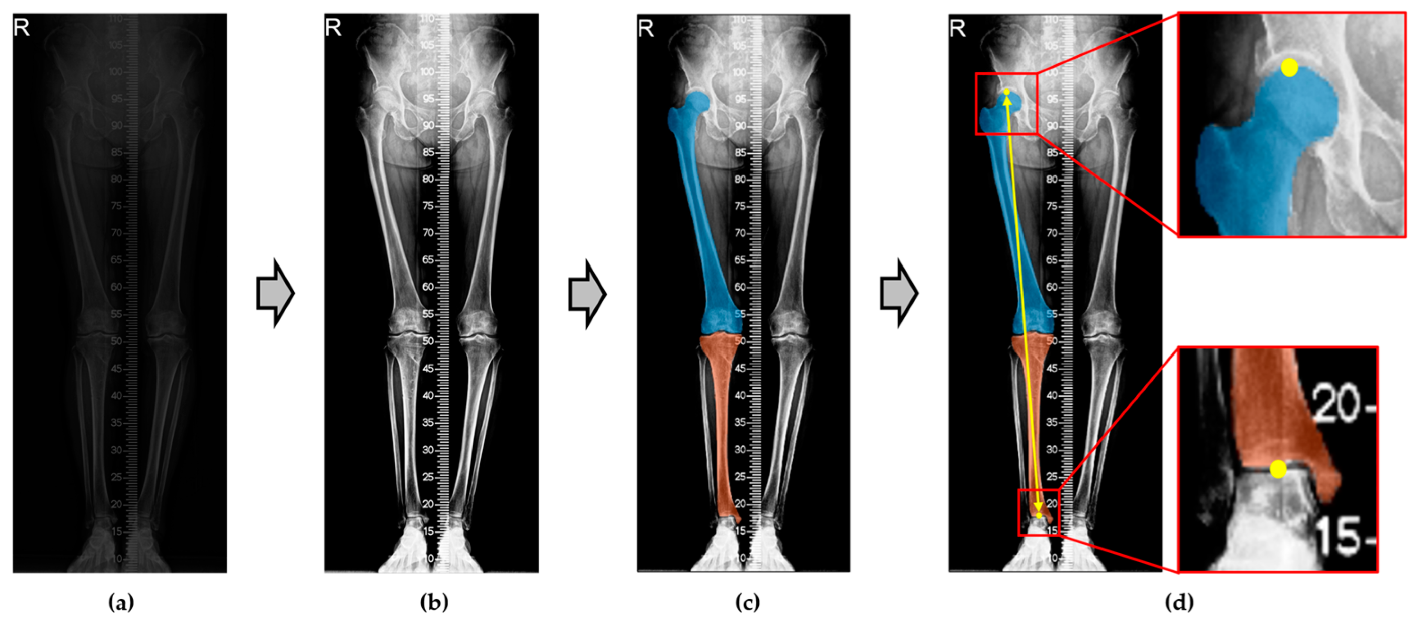 Electronics 14 00160 g003