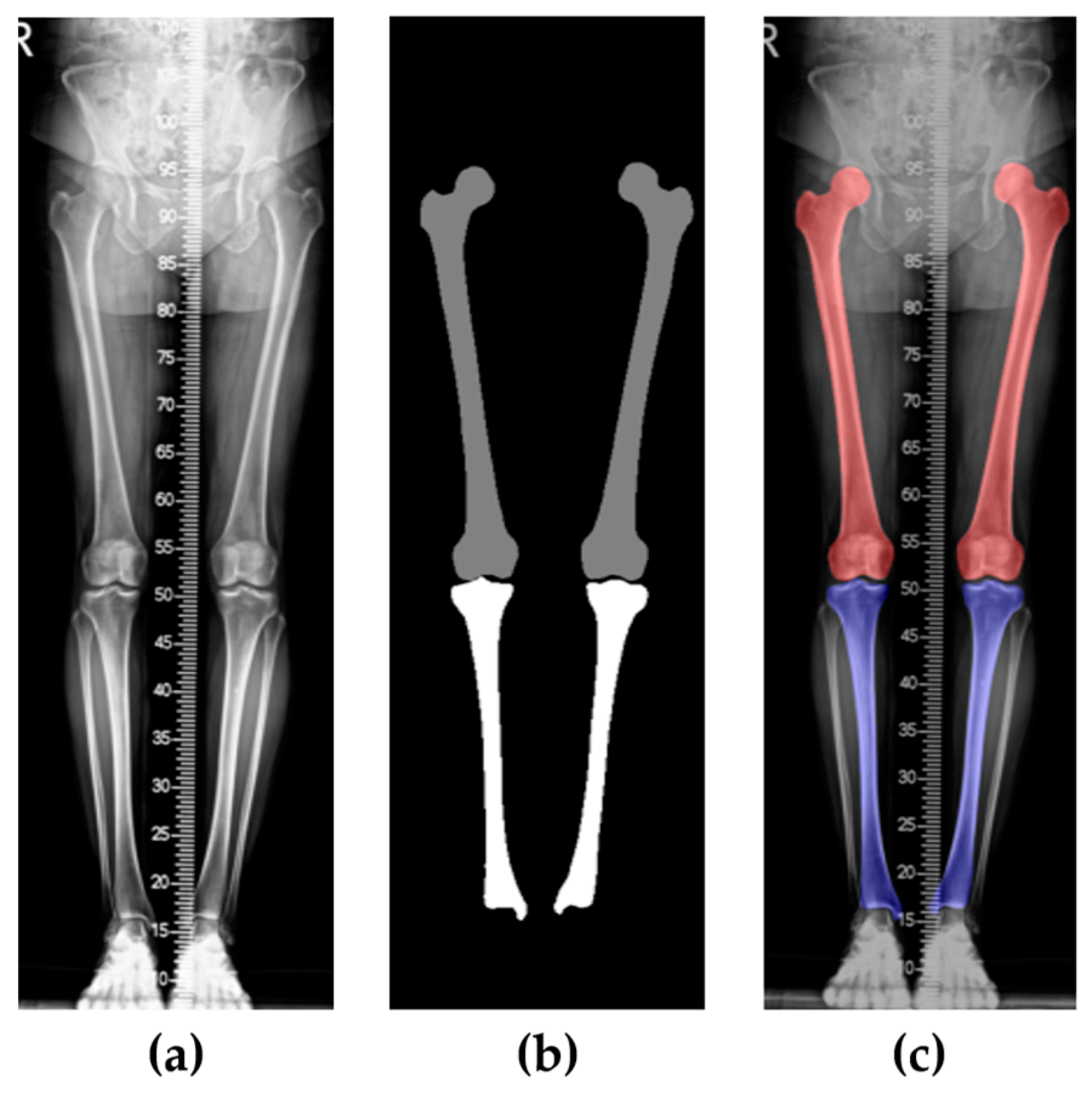 Electronics 14 00160 g004