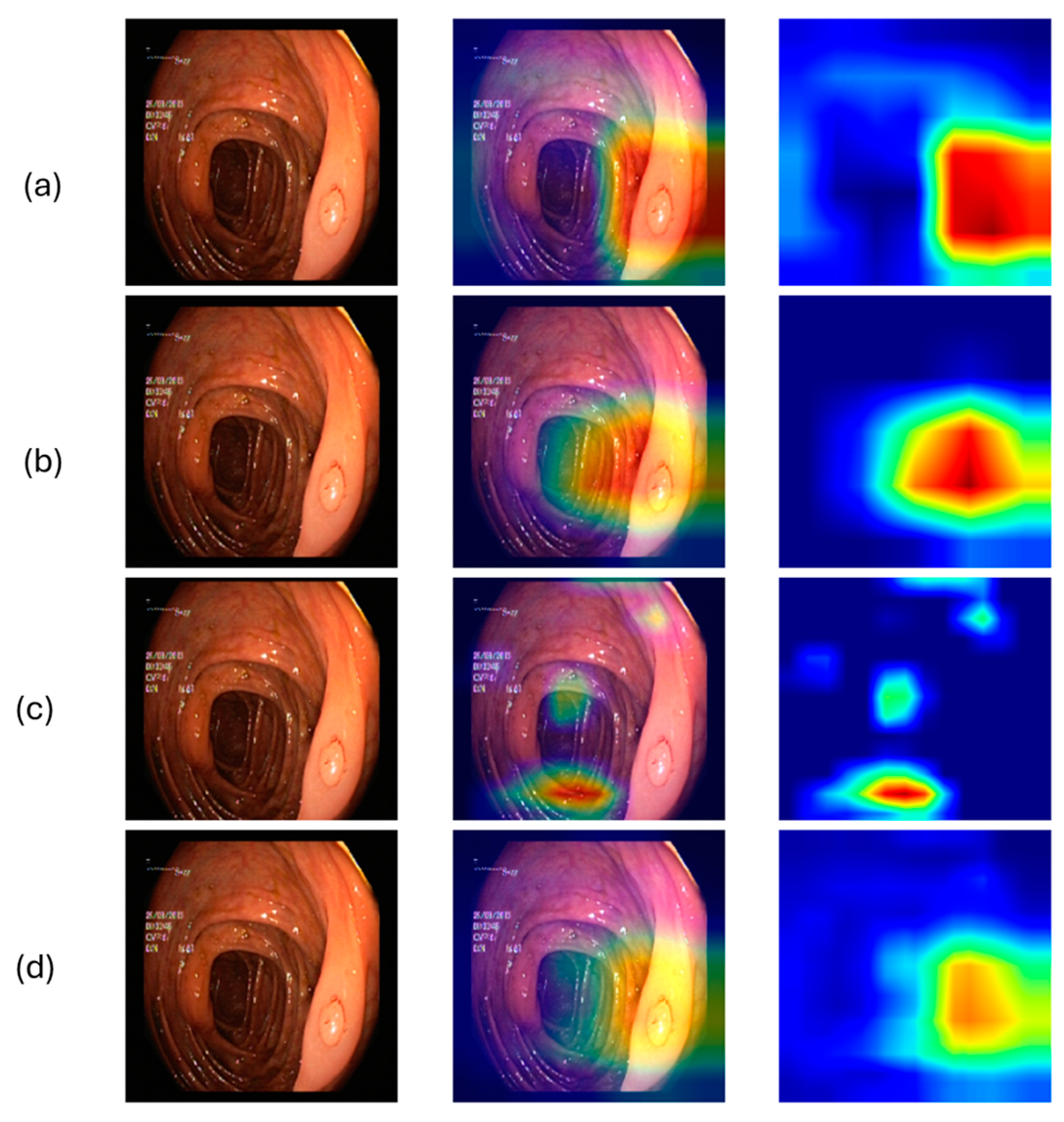 Electronics 14 00305 g007