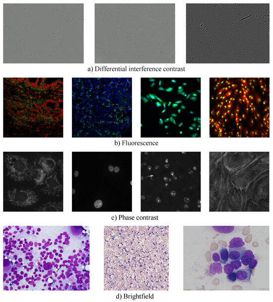 ResShift-4E: Improved Diffusion Model for Super-Resolution with ...