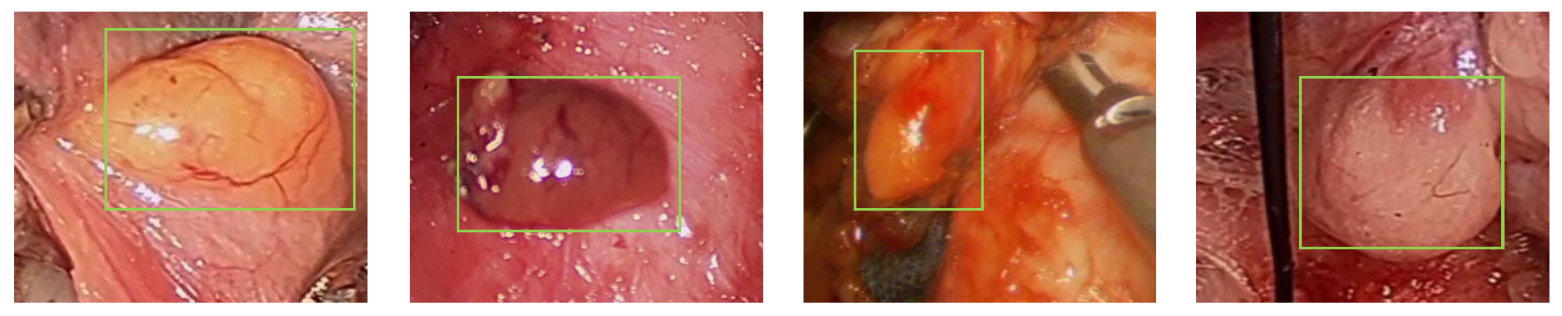 Electronics 14 01092 g003