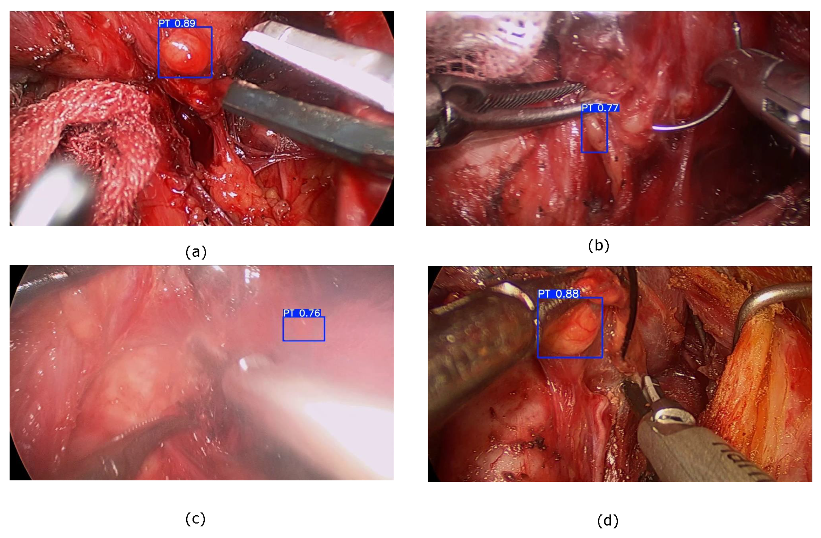 Electronics 14 01092 g009