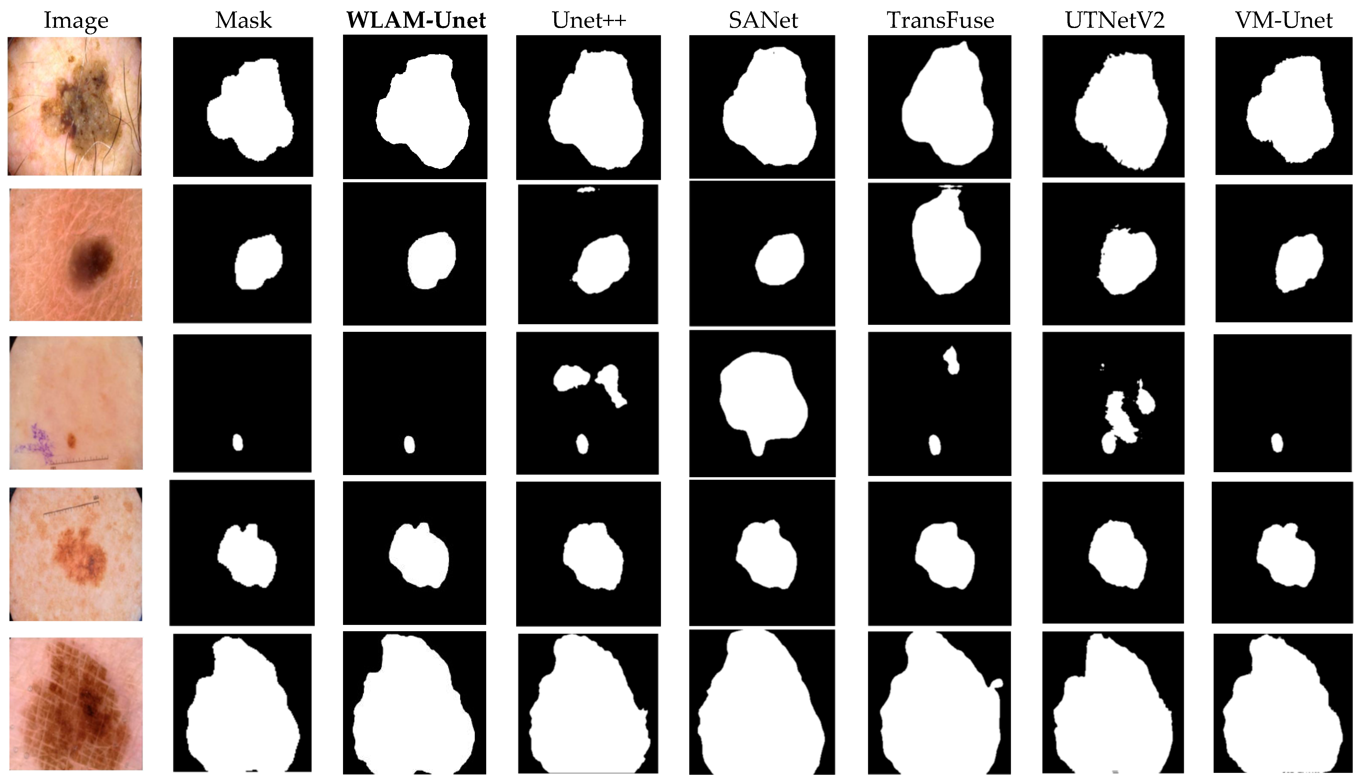 Electronics 14 01246 g006