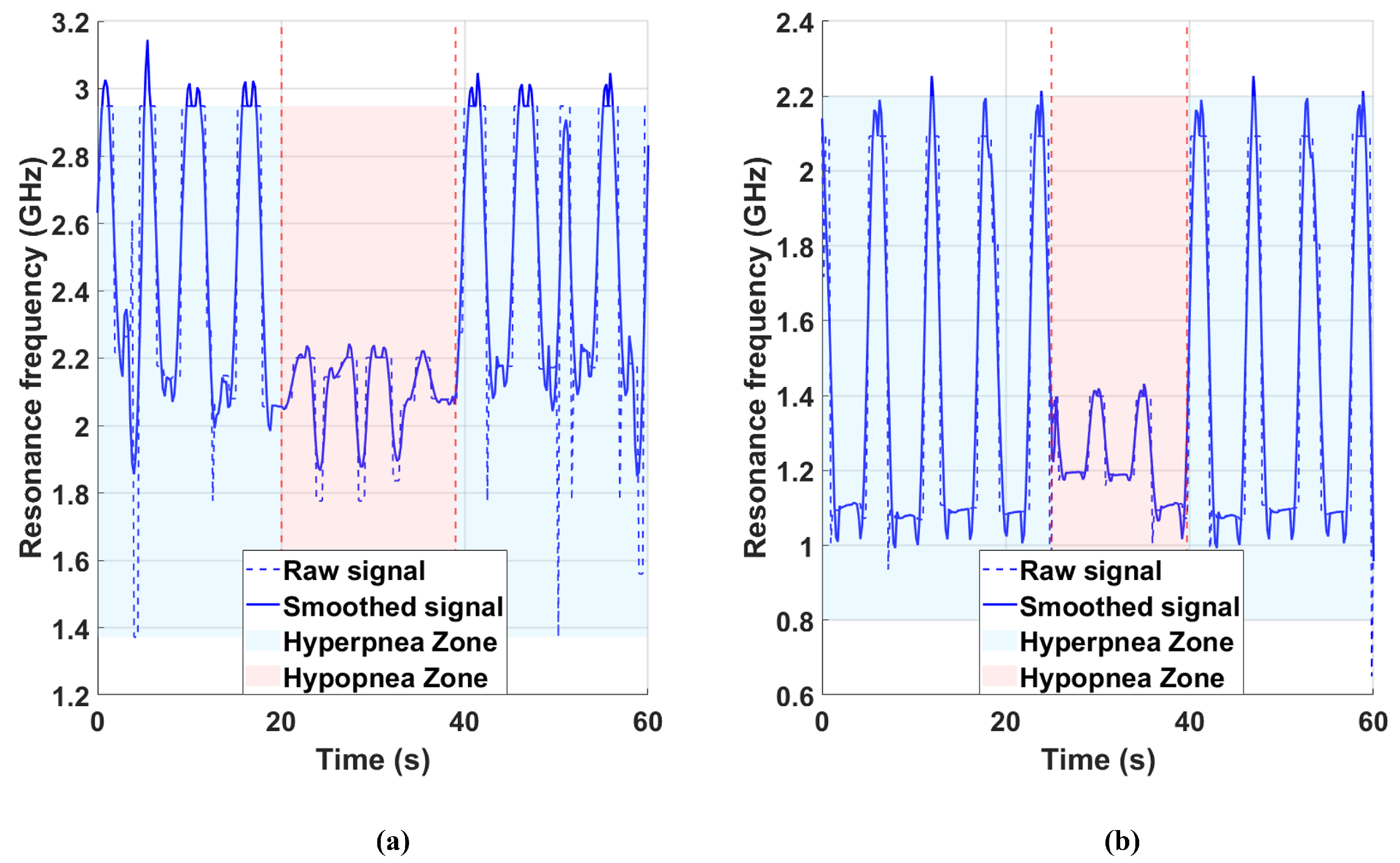 Electronics 14 02084 g008