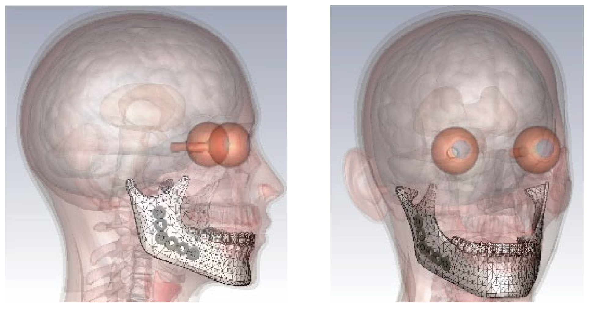 Electronics 14 02096 g004 Electronics 14 02096 g004
