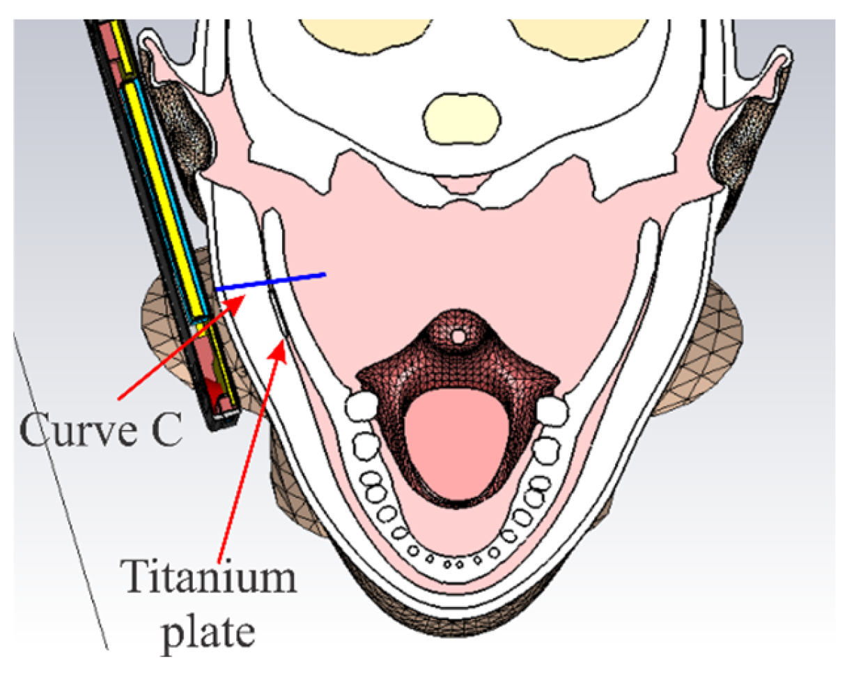 Electronics 14 02096 g012 Electronics 14 02096 g012