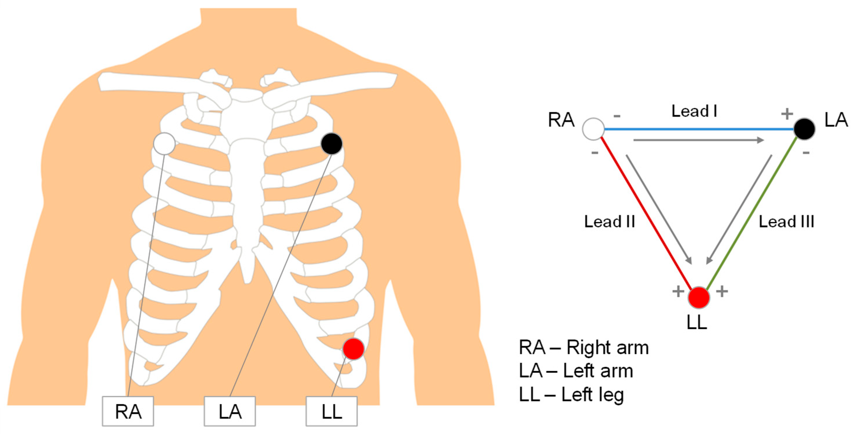 Electronics 14 02468 g001