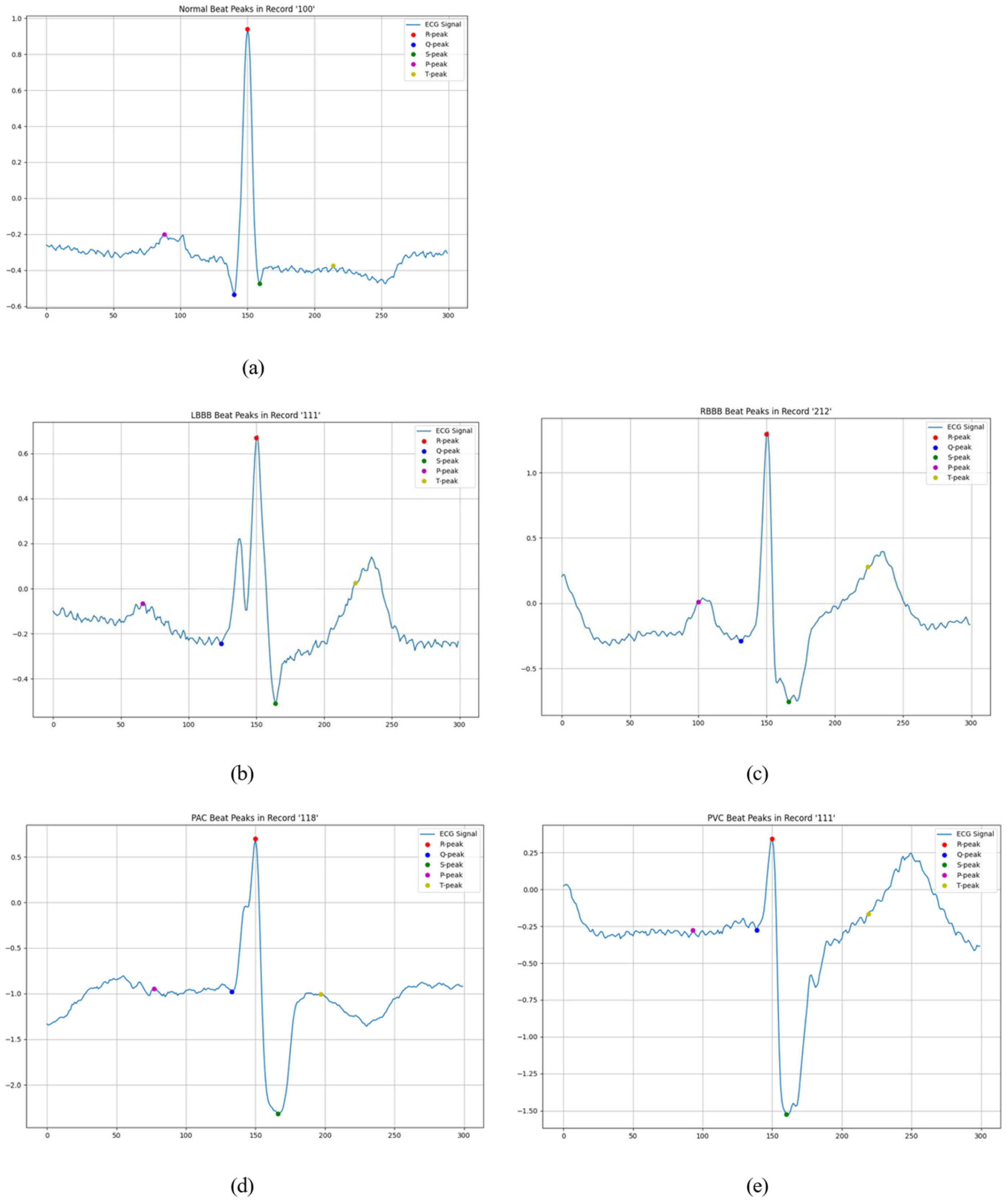 Electronics 14 02509 g004