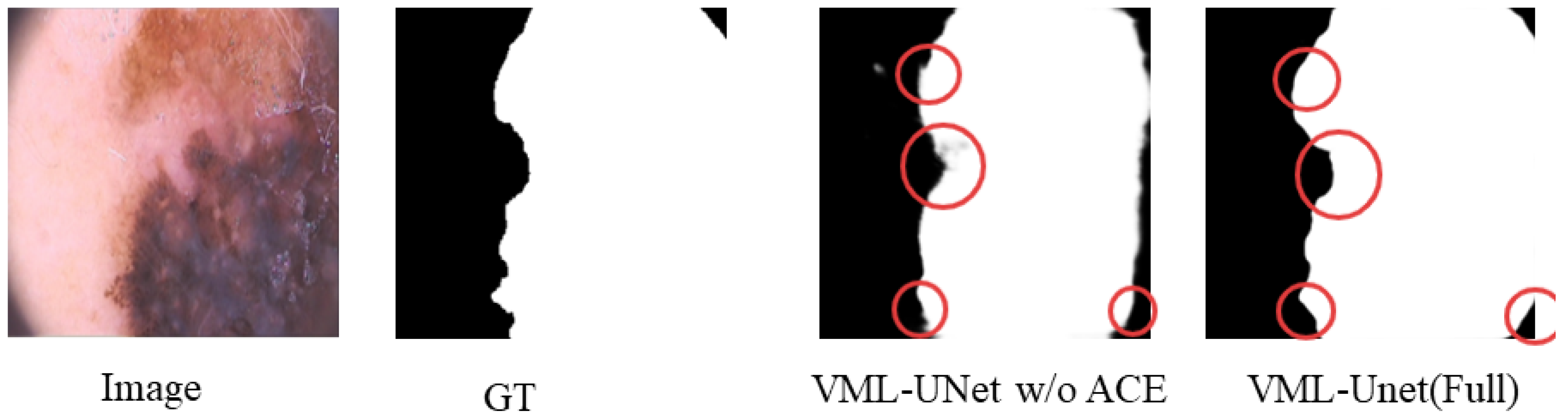 Electronics 14 02866 g011