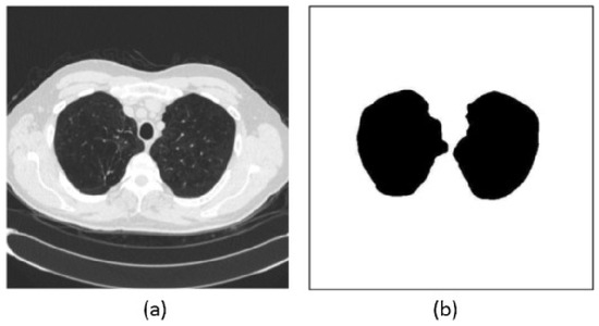 Multi-Task Deep Learning for Lung Nodule Detection and Segmentation in ...