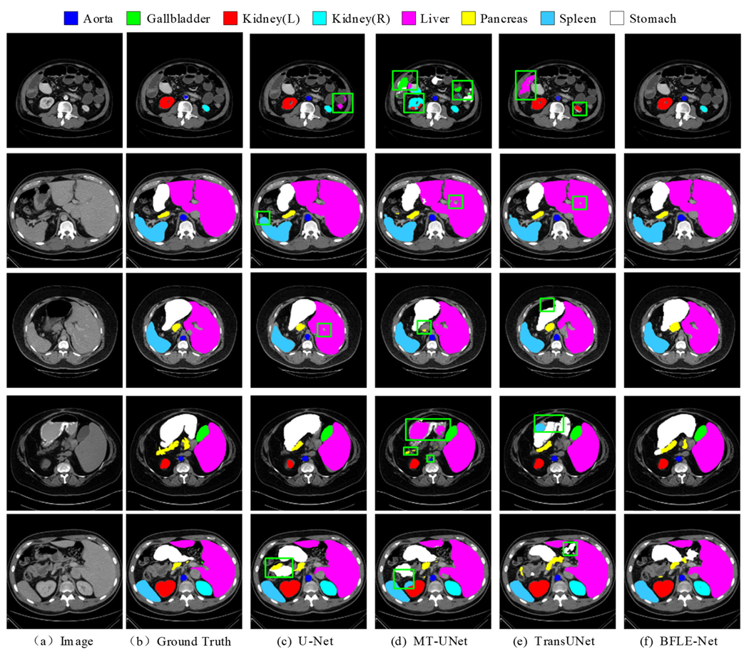 Electronics 14 03054 g006