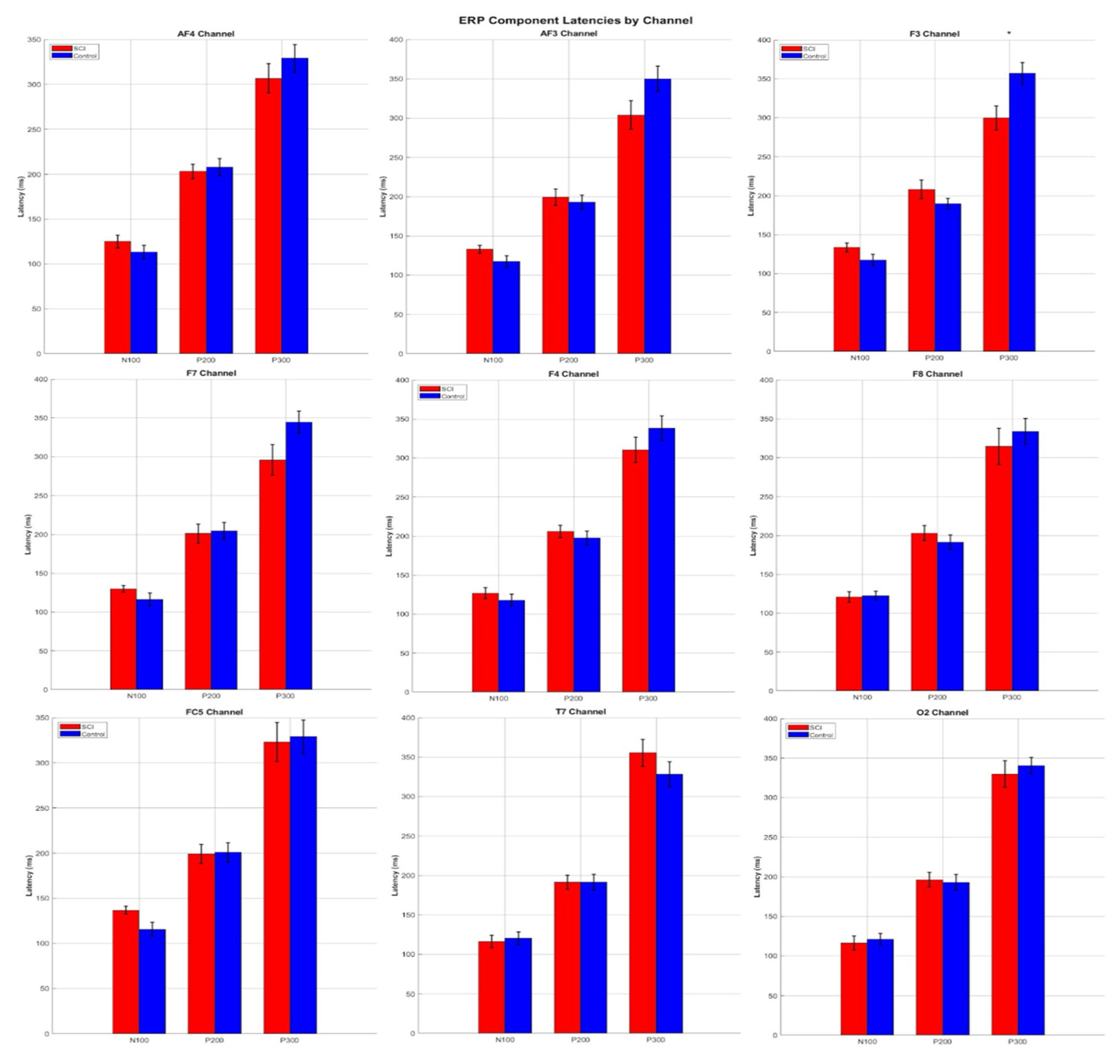 Electronics 14 03106 g007a