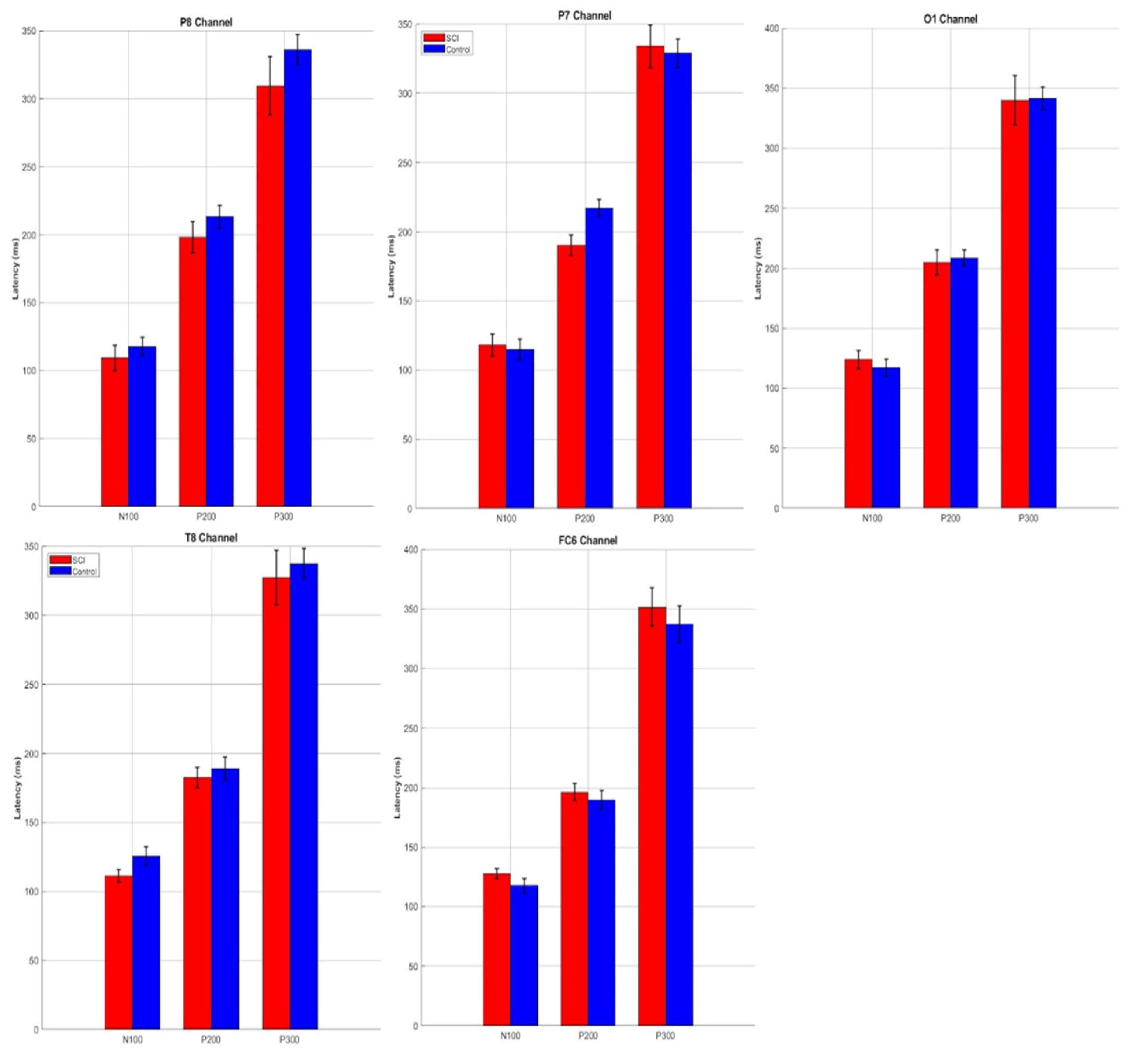 Electronics 14 03106 g007b