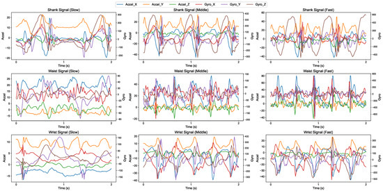Analysis of Sensor Location and Time–Frequency Feature Contributions in ...