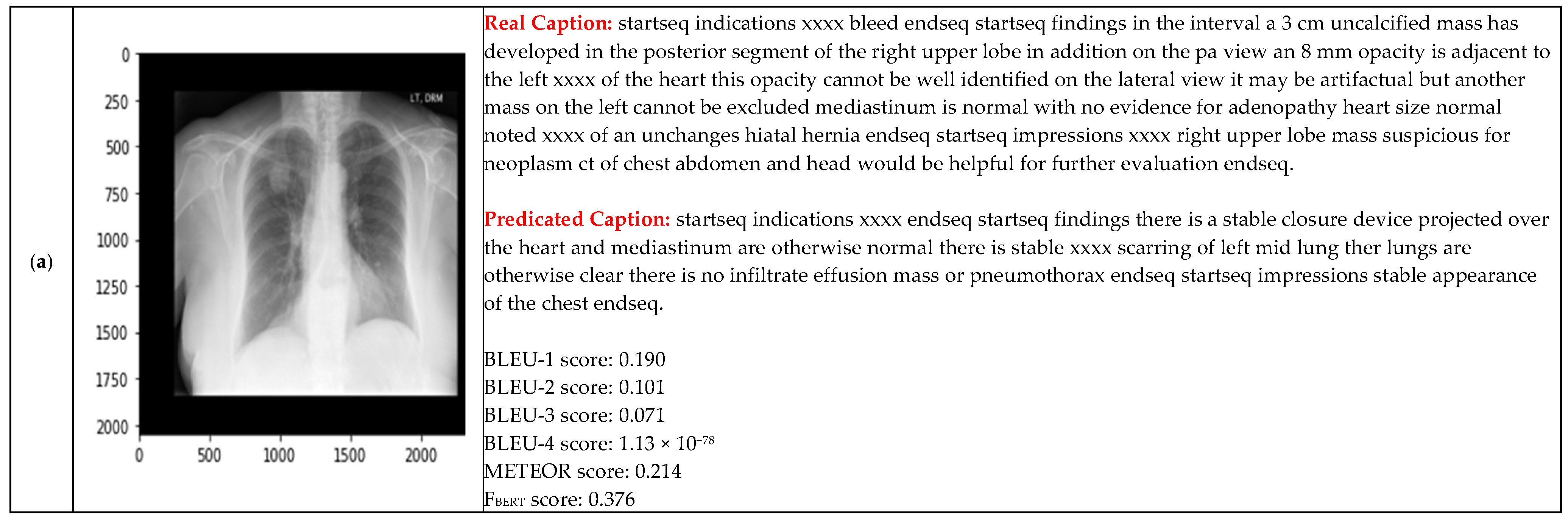 Electronics 14 04123 g011a