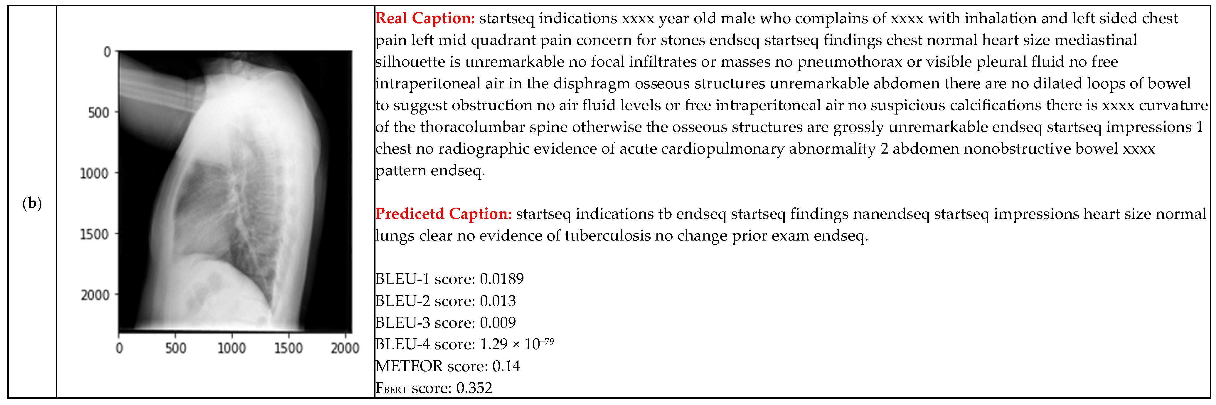Electronics 14 04123 g011b