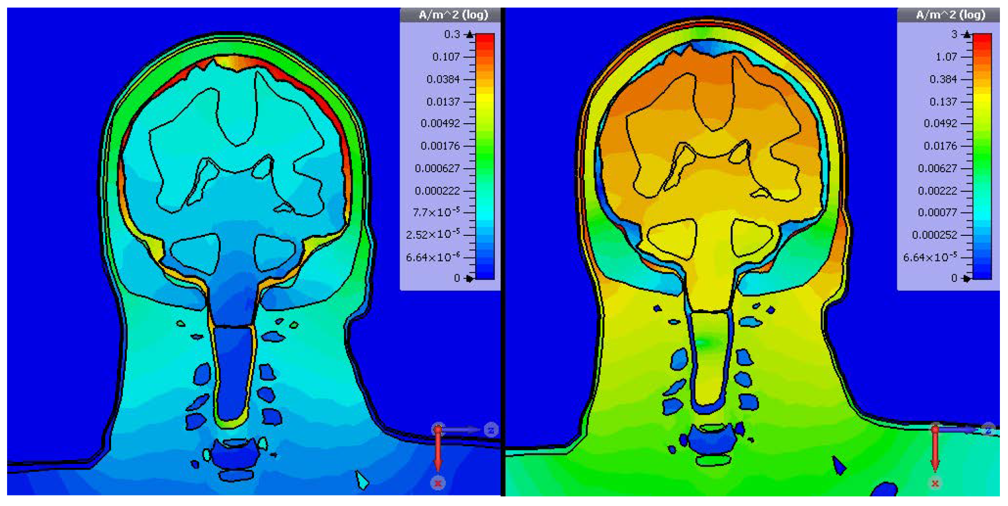 Electronics 14 04410 g012