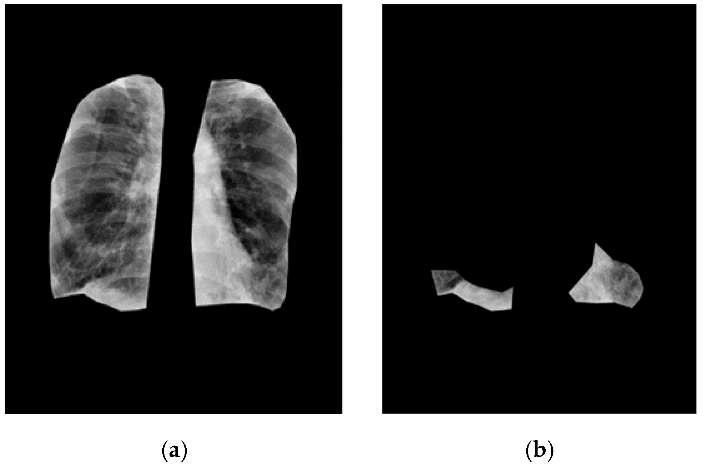 Electronics 14 04610 g006