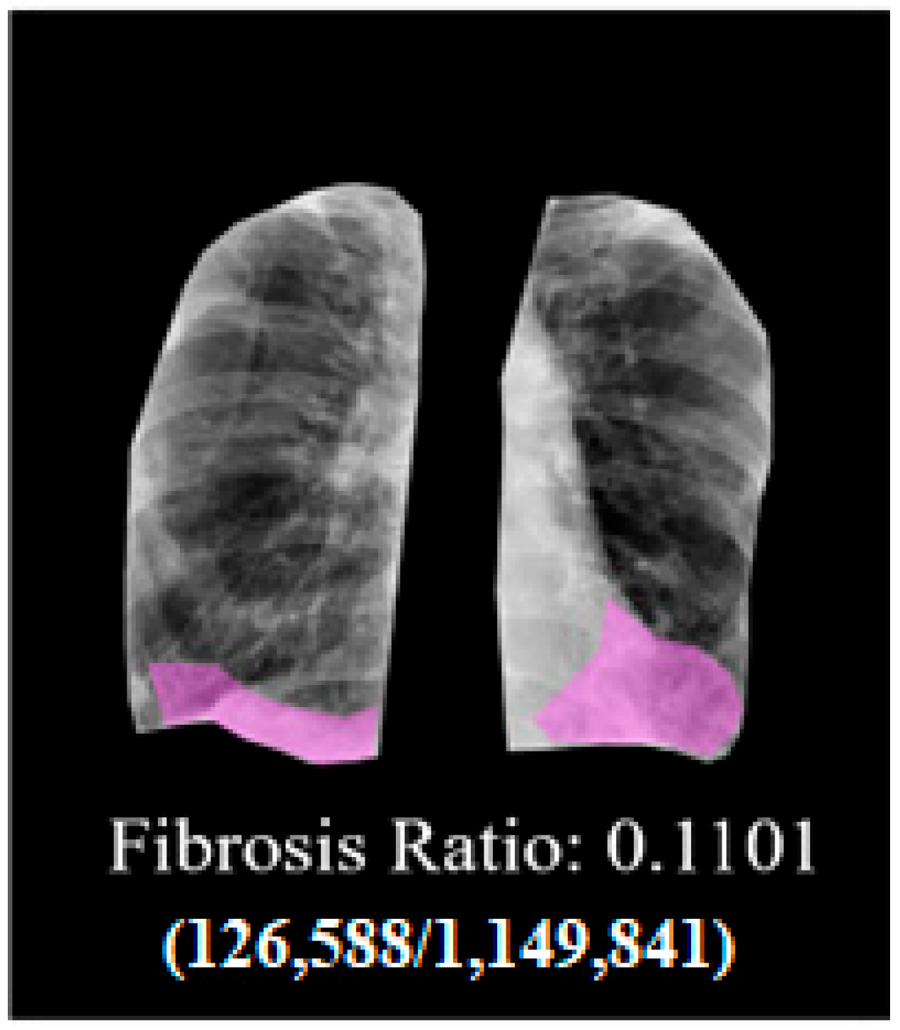 Electronics 14 04610 g007
