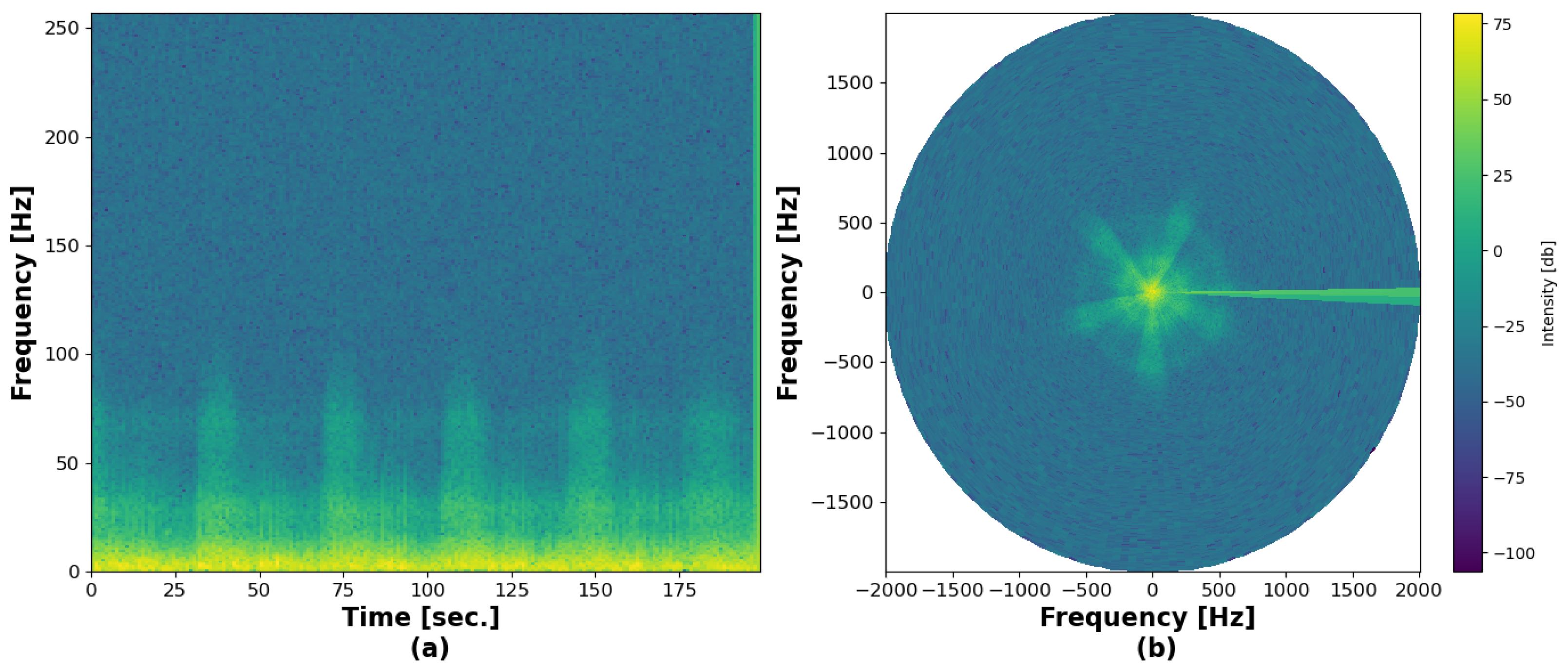 Normalized Stft Lung Disease Diagnosis Using Radial STFT and a Lightweight ...