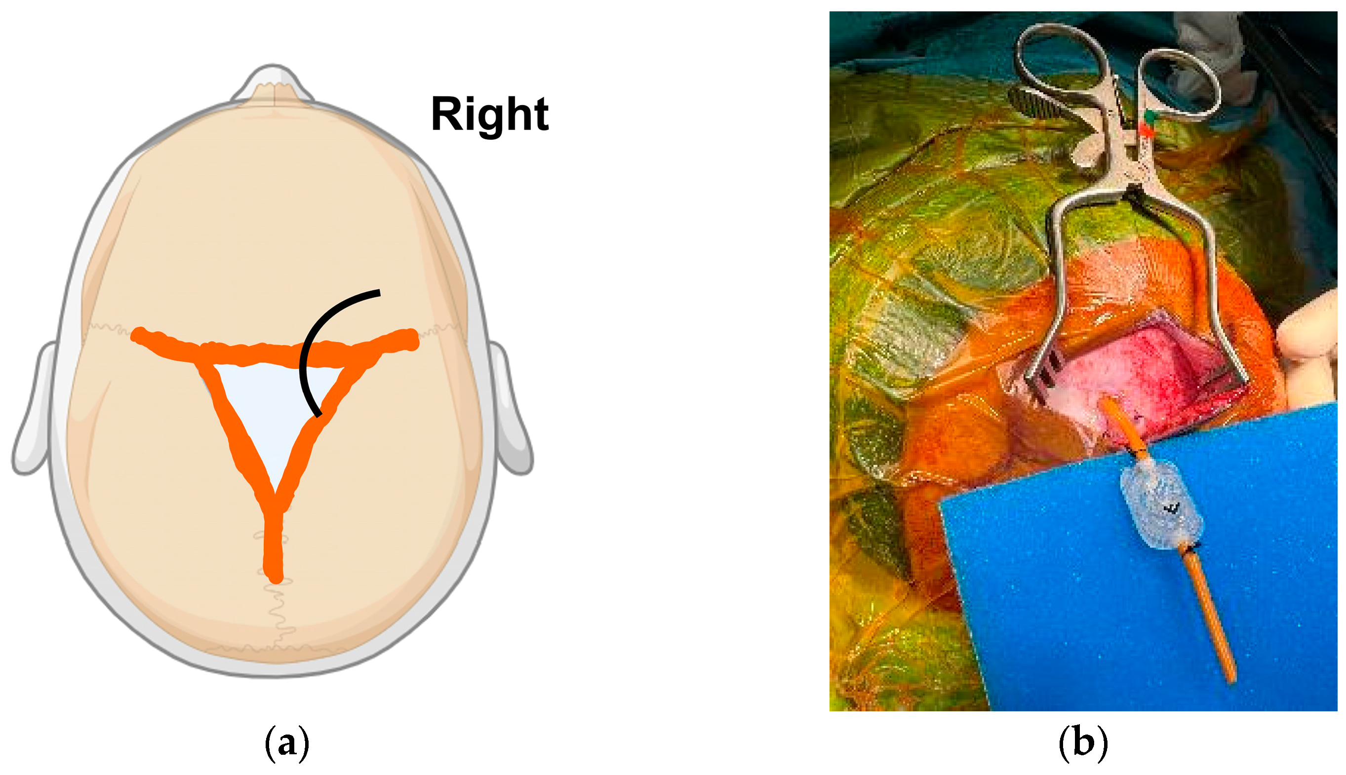 Encyclopedia 04 00127 g003 Encyclopedia 04 00127 g003