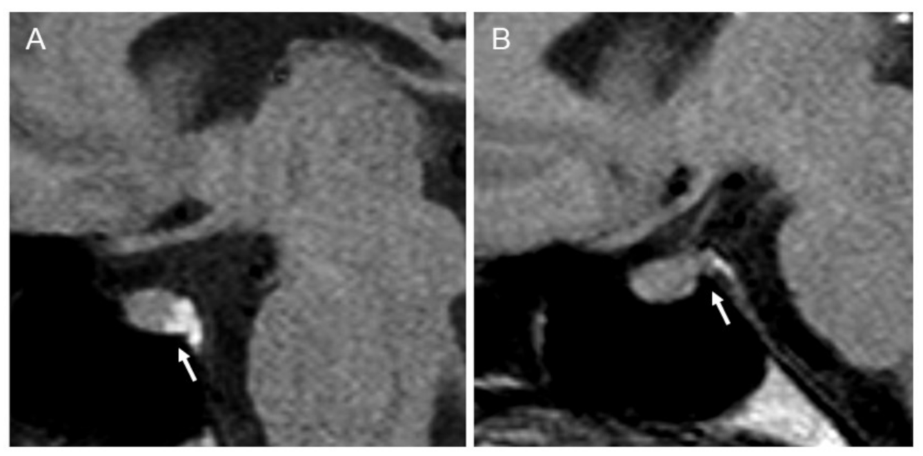 Endocrines 02 00004 g002