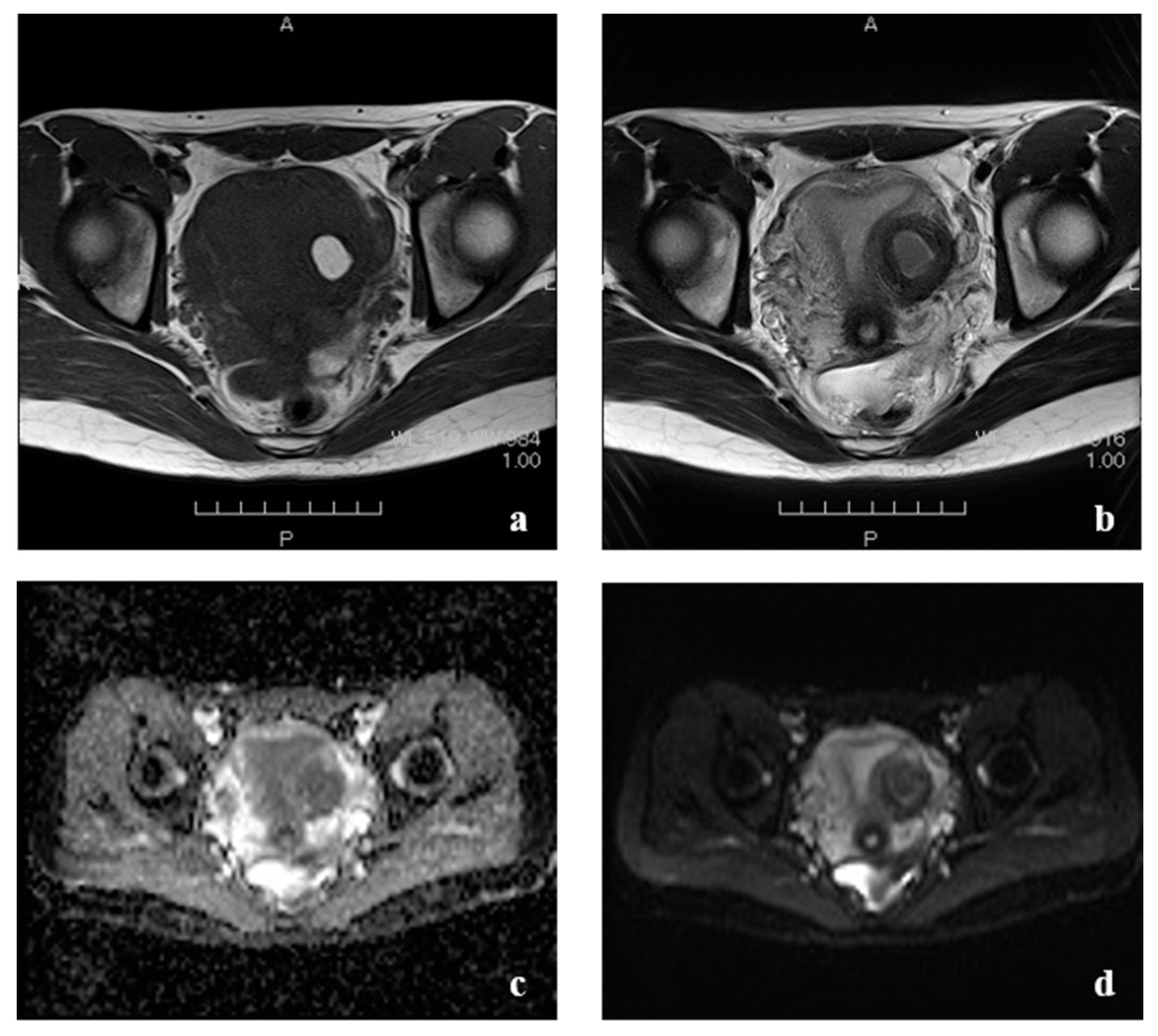 Endocrines 02 00026 g003 550