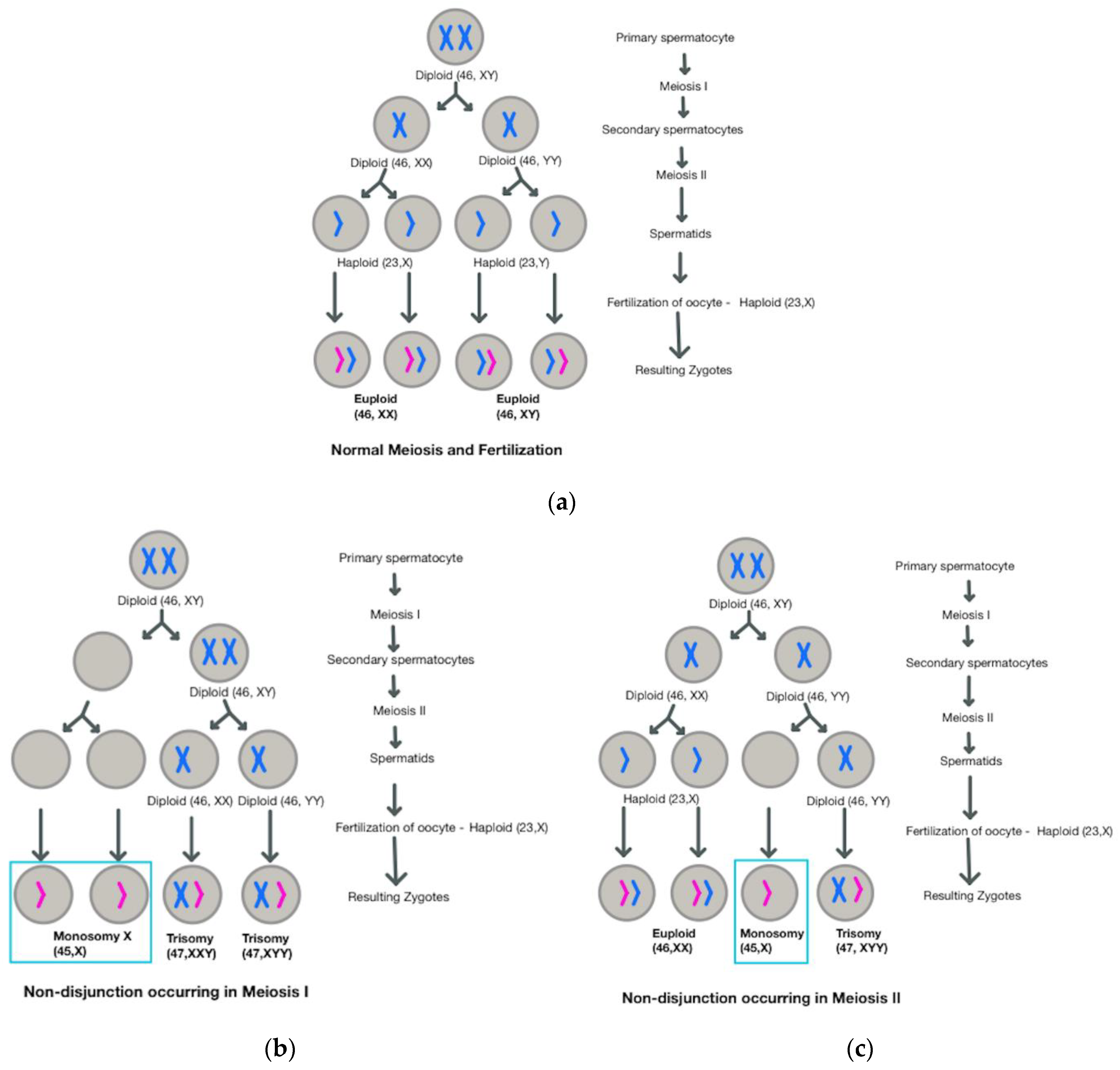 Endocrines Free FullText Turner Syndrome