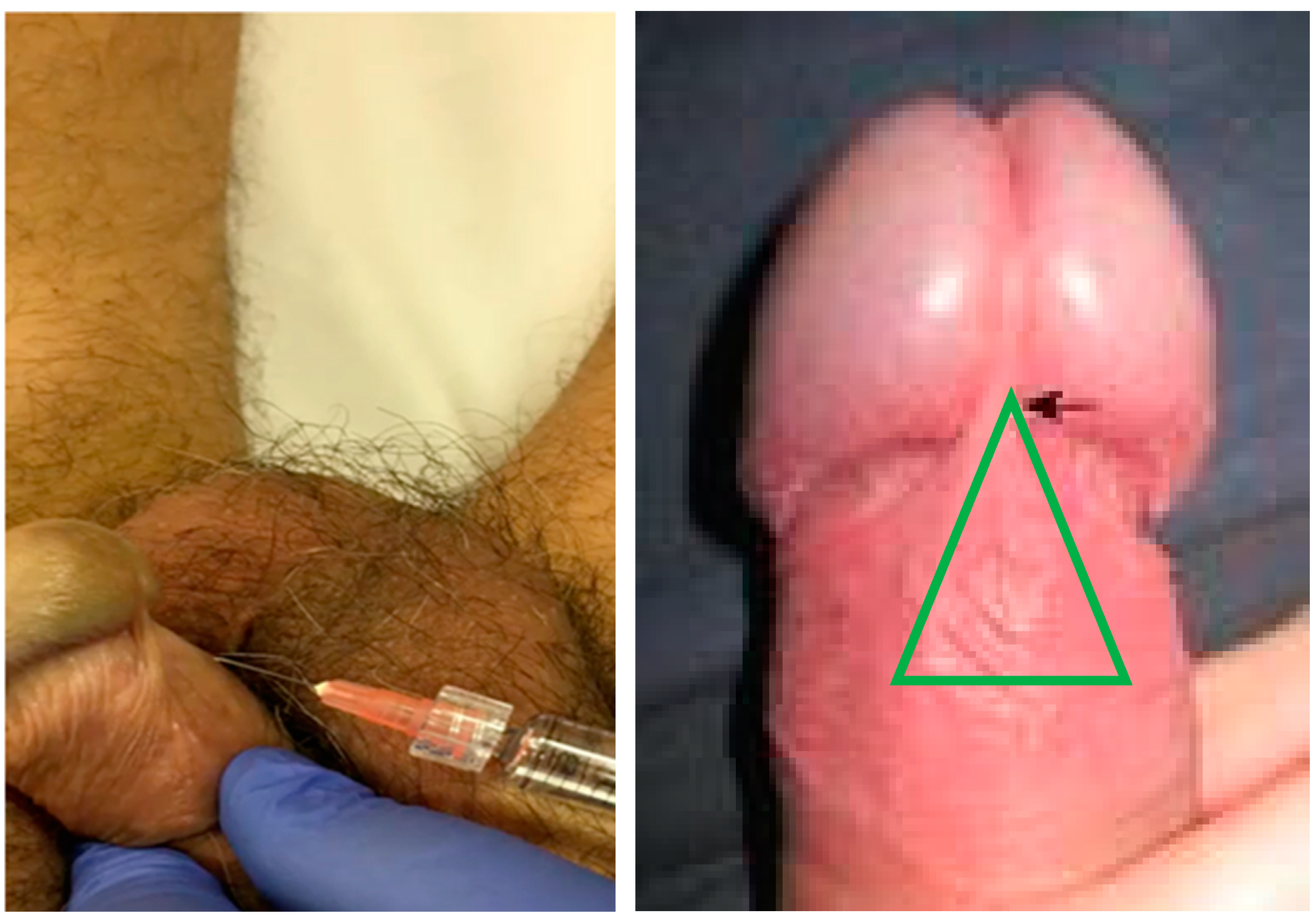 Endocrines 03 00044 g001 Endocrines 03 00044 g001