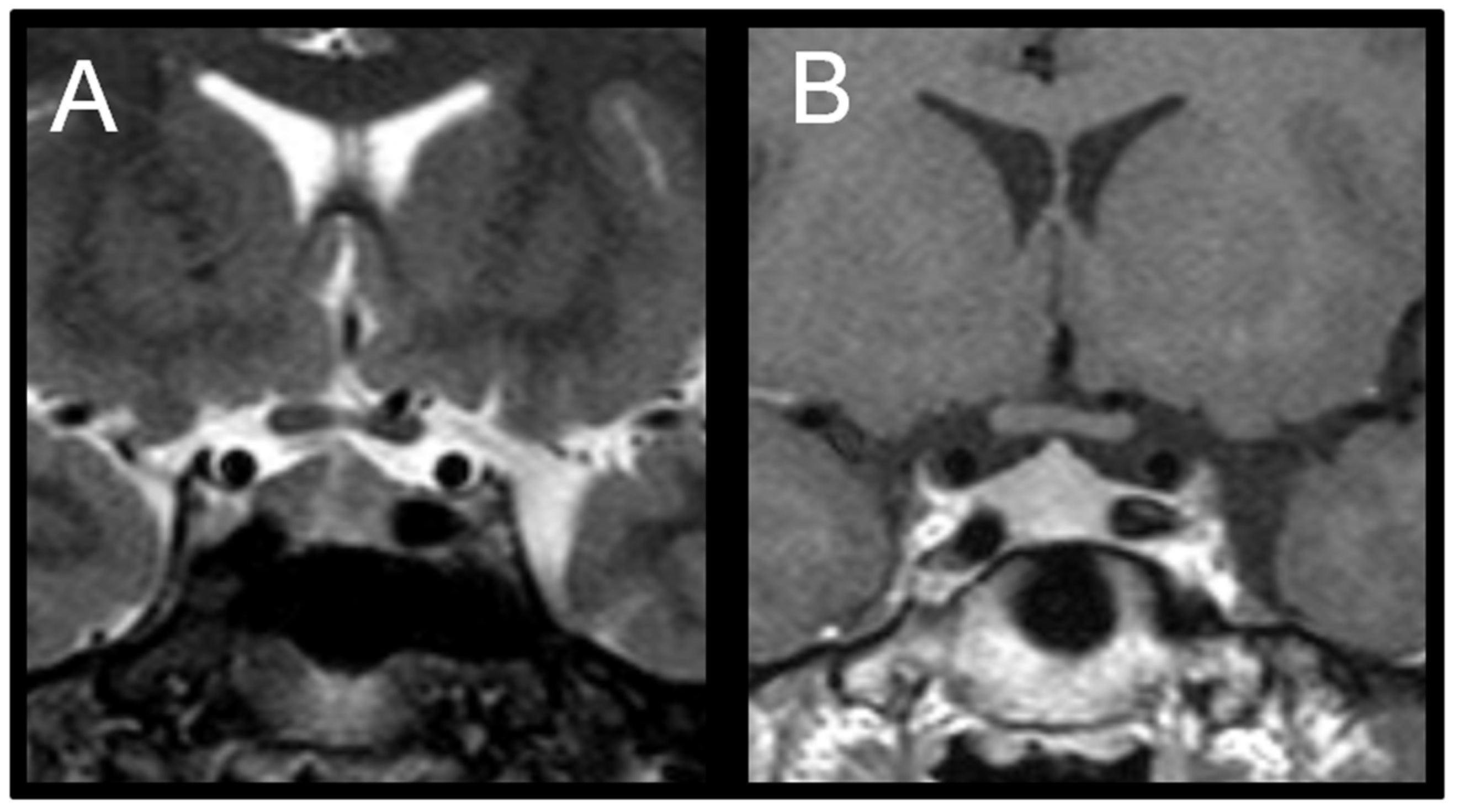 Endocrines 04 00046 g002
