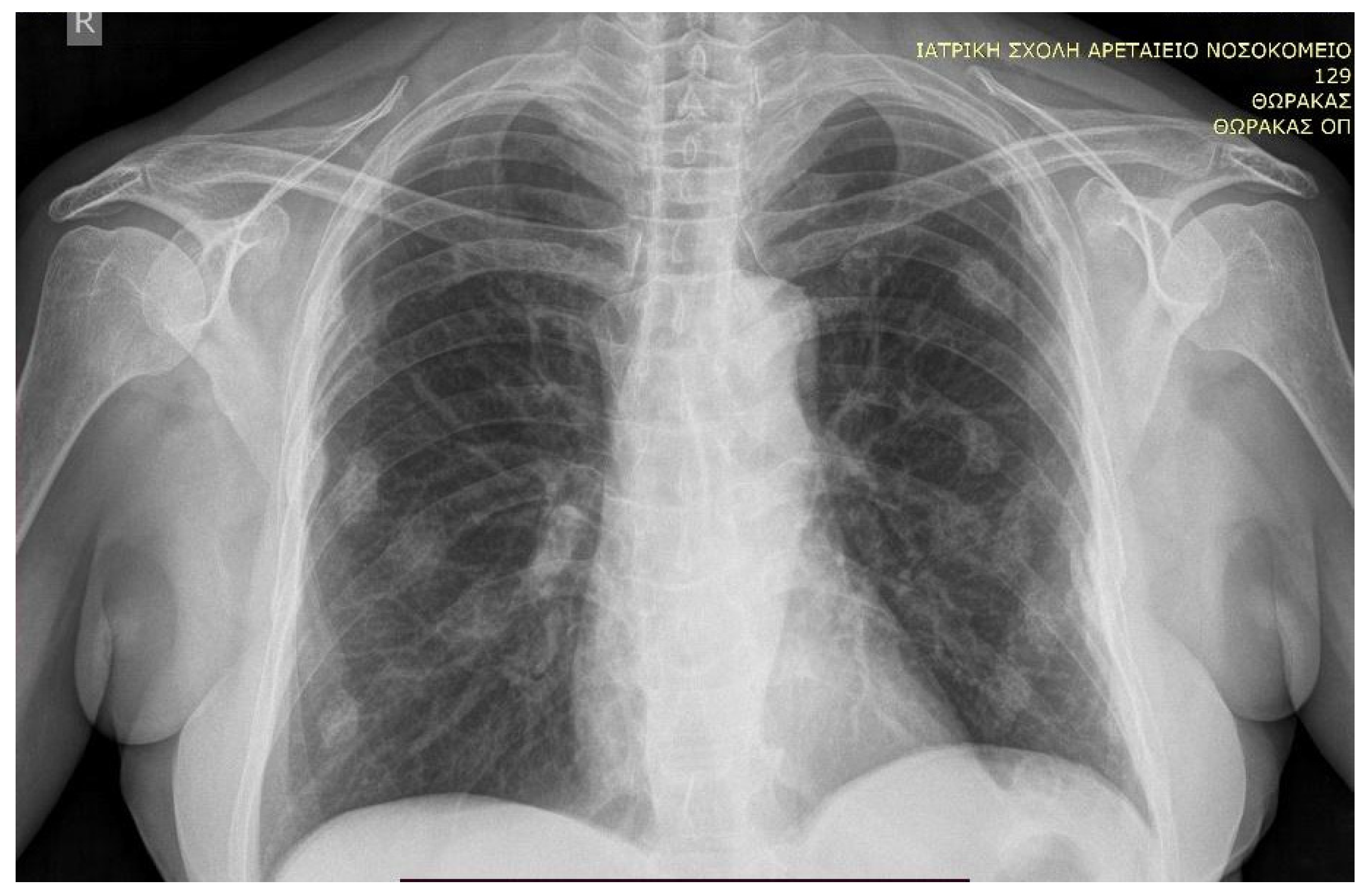 Endocrines 05 00043 g003