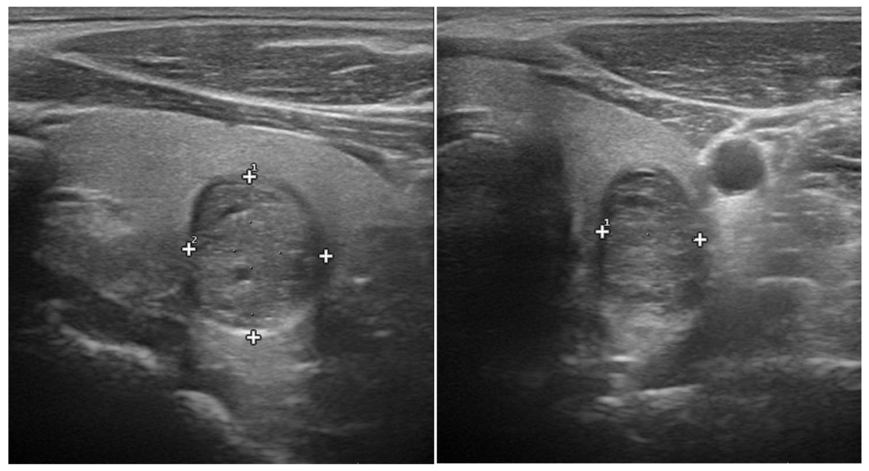 Endocrines 06 00015 g001