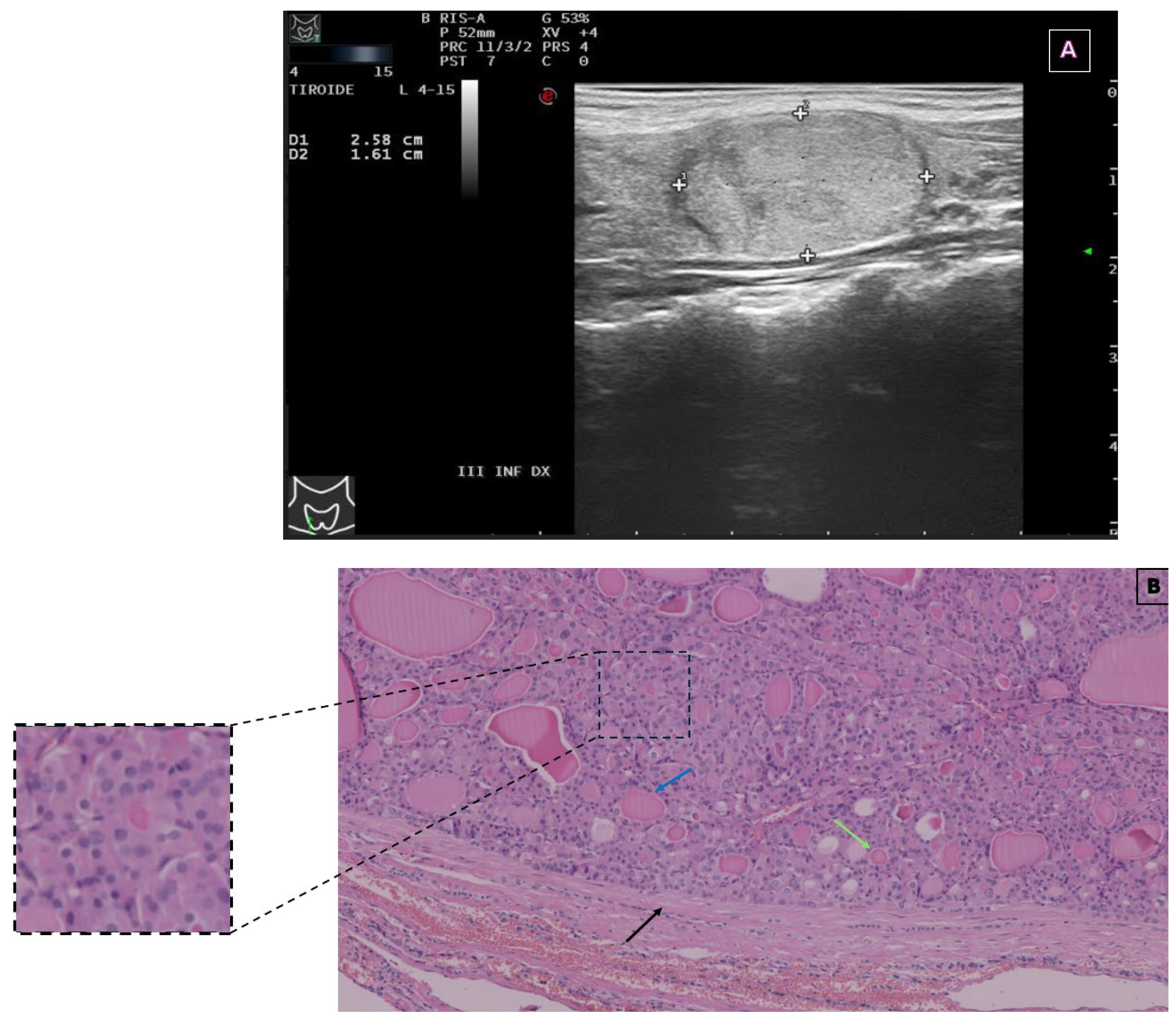 Endocrines 06 00022 g001