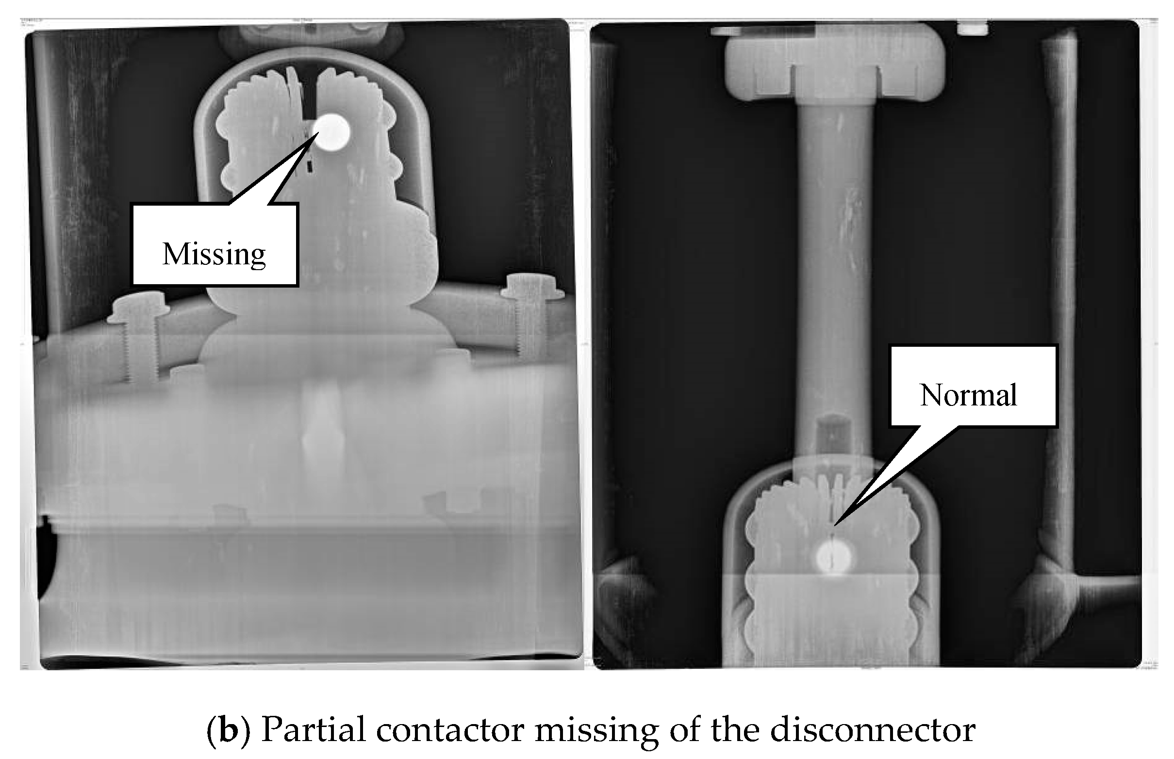 Detection and Diagnosis of Defect in GIS Based on X-ray Digital Imaging ...
