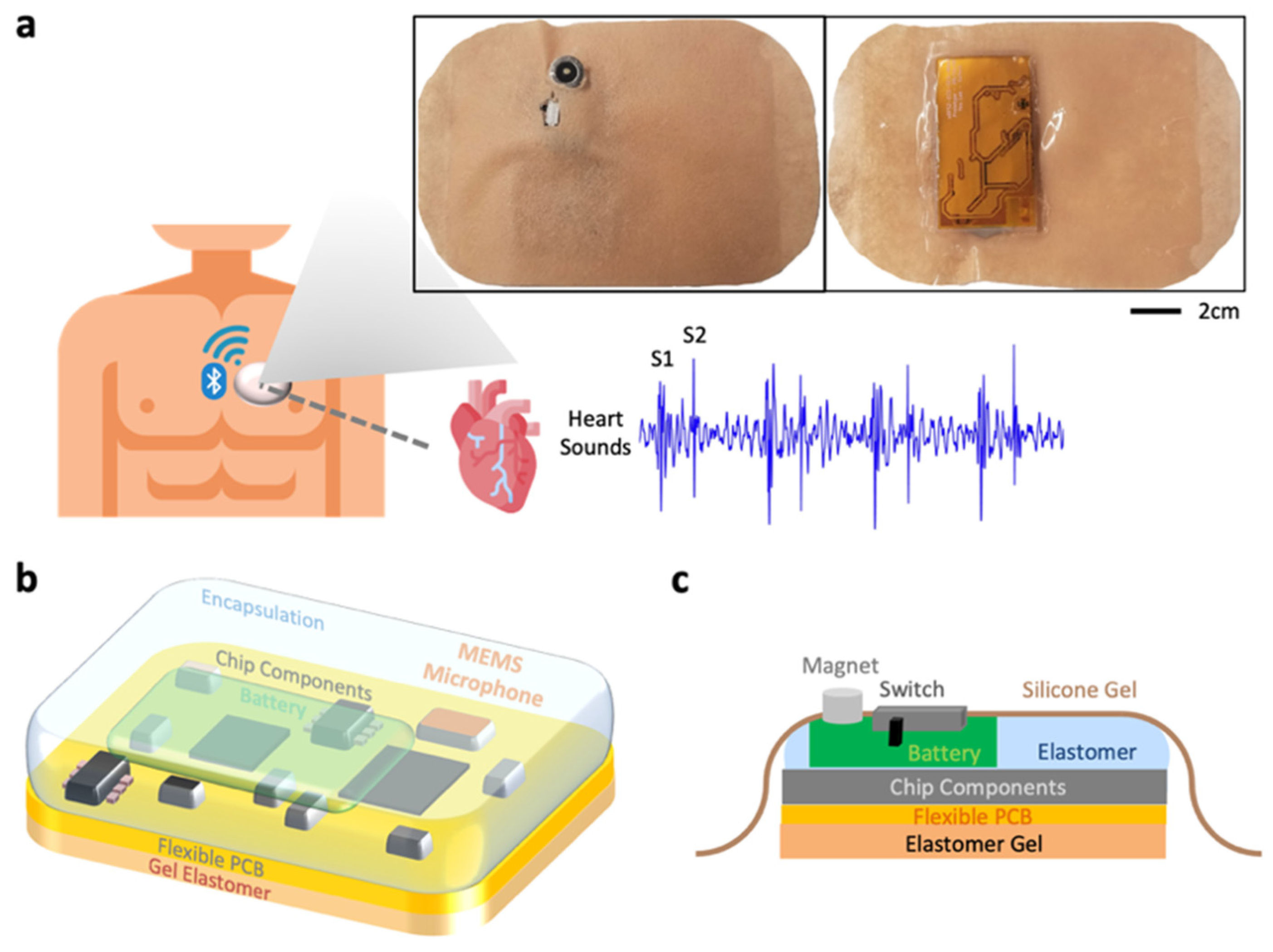 Engineering Proceedings Free FullText Soft Wearable Patch for