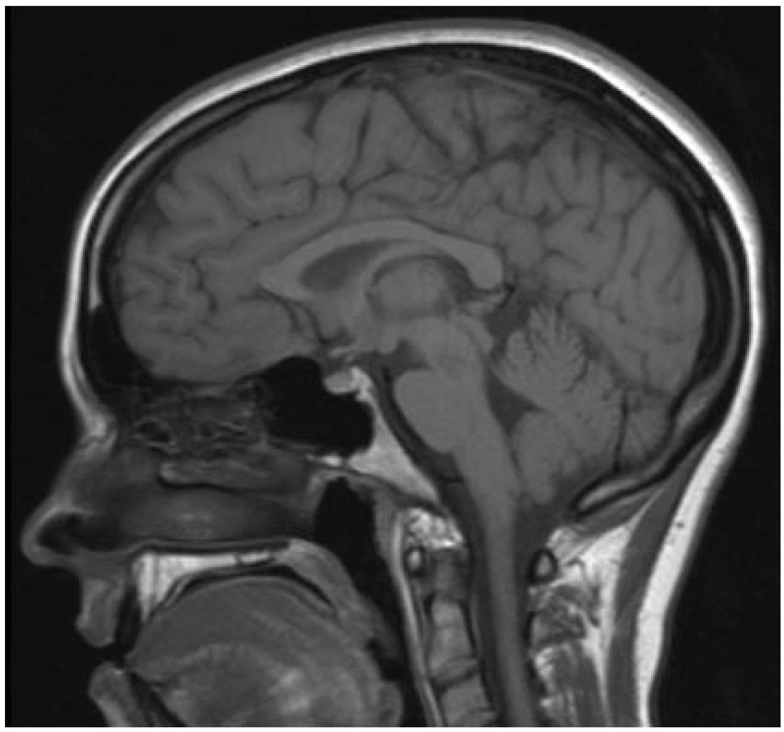 Engproc 33 00047 g003