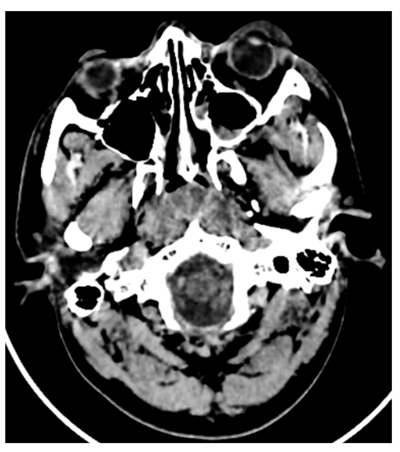 Engproc 34 00001 g005 550