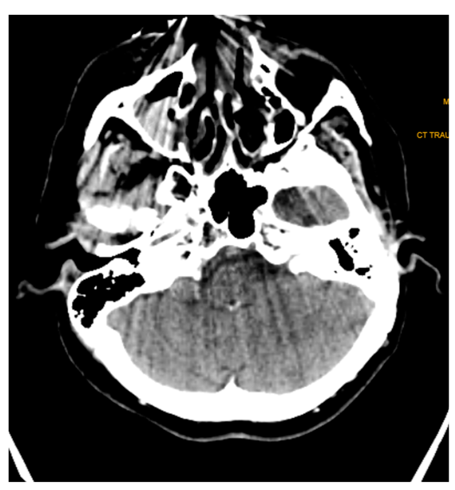 Engproc 34 00001 g007 550