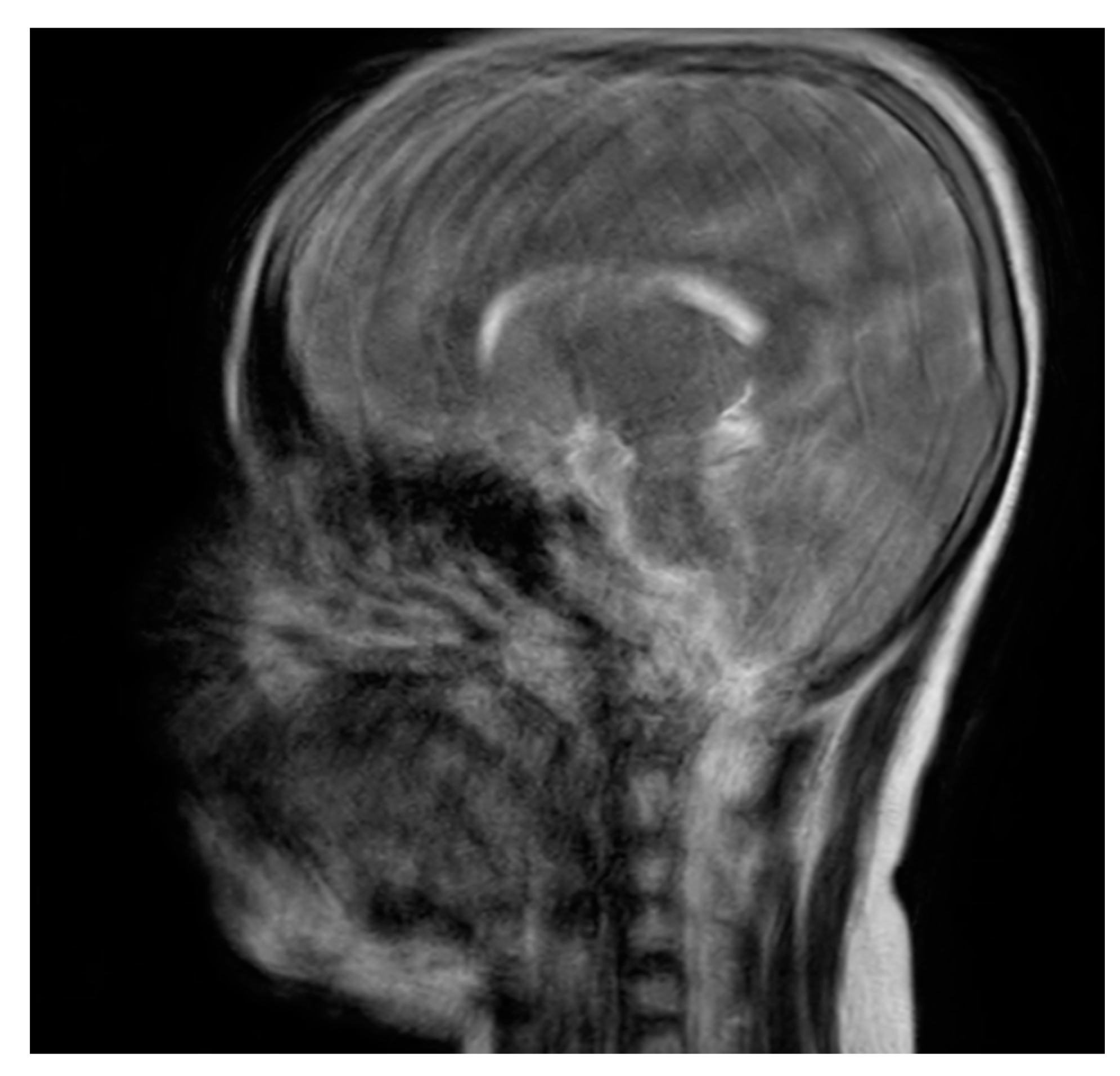 Engproc 34 00001 g008 550