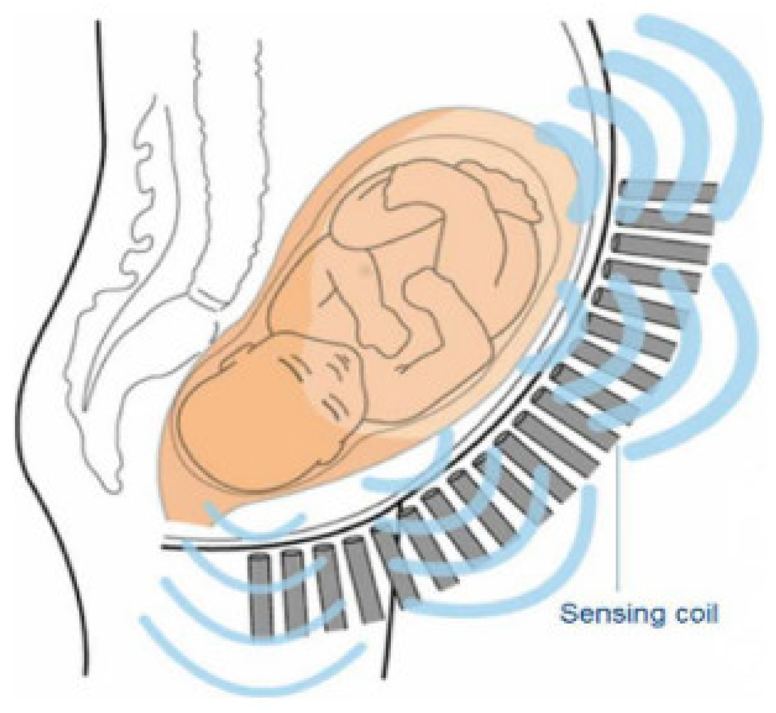 Engproc 58 00125 g001