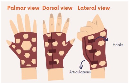 Design, Manufacturing and Mechanical Evaluation of a 3D Printed ...
