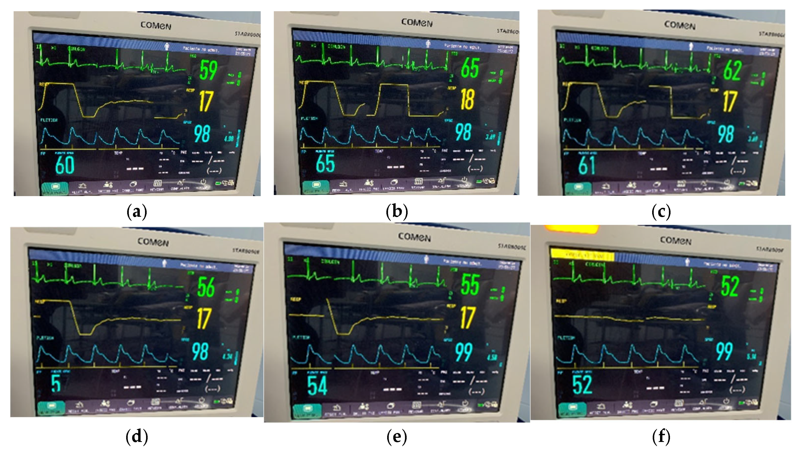 Engproc 83 00019 g015