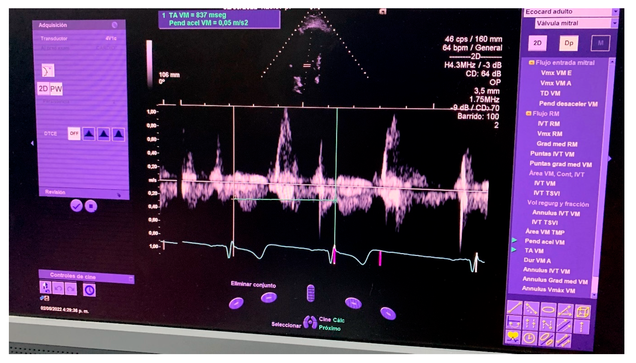Engproc 83 00019 g016