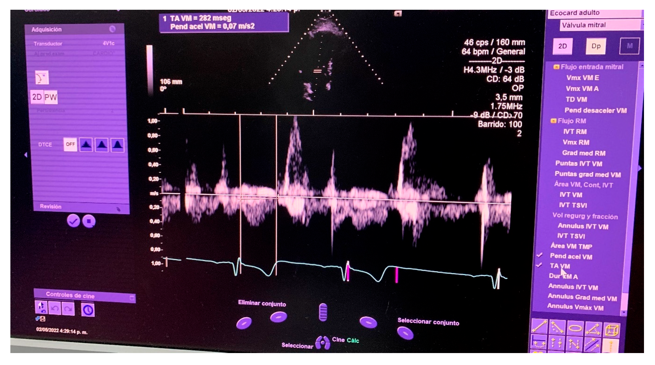Engproc 83 00019 g017
