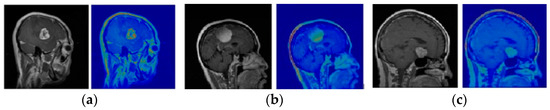 Comparative Study of CNN Architectures for Brain Tumor Classification ...