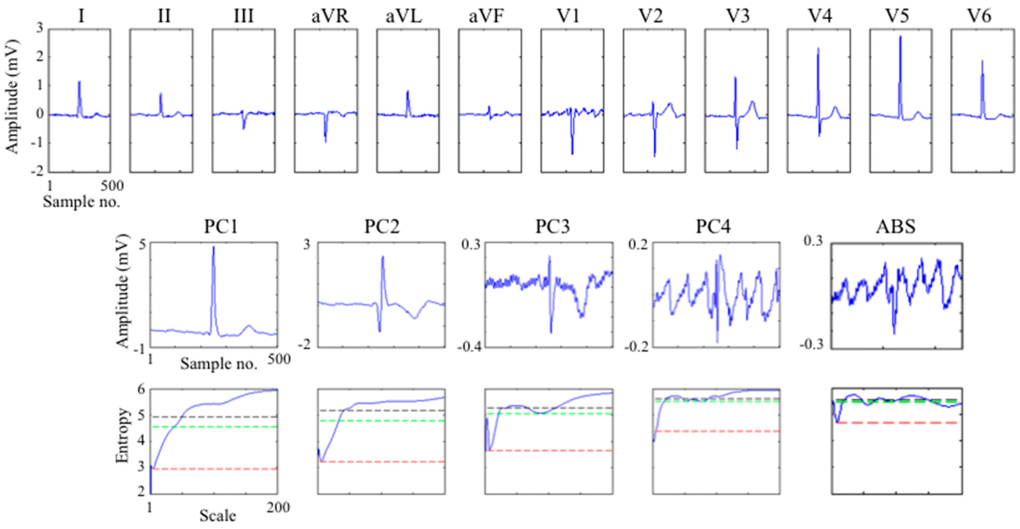Entropy 17 06397 g005 1024
